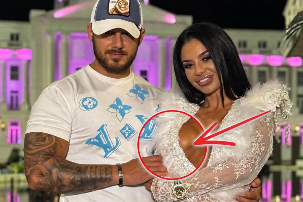 SANJI GRUJIĆ PROPALI SILIKONI U GRUDIMA! Rijaliti zvezda uložila velike pare u izgled, a ovo što se njoj desilo nijenda žena ne bi poželela