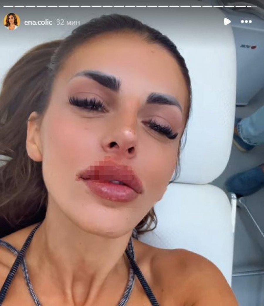 KRVAVA ENA ČOLIĆ! Učesnica "Elite 8" OBELODANILA SVE, evo šta se zapravo dogodilo! (VIDEO)