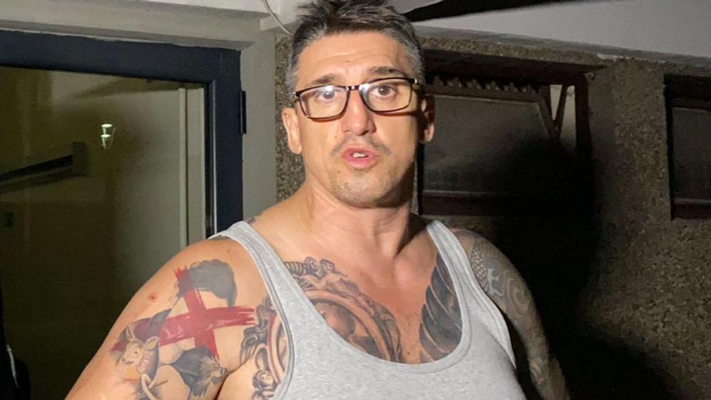 Kristijan Golubović završio kod plastičara: Evo šta koriguje, drži Kristinu za ruku