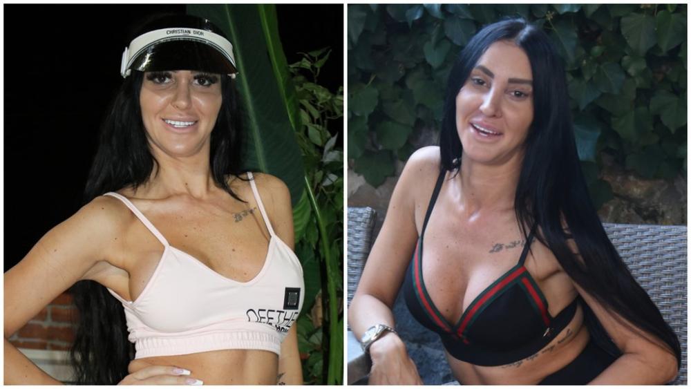NOVO LICE SLAĐE PORŠELINE! Ovako starleta izgleda posle NOVOG REMONTA: Tri intervencije u jednom danu, ovo je rezultat (FOTO)