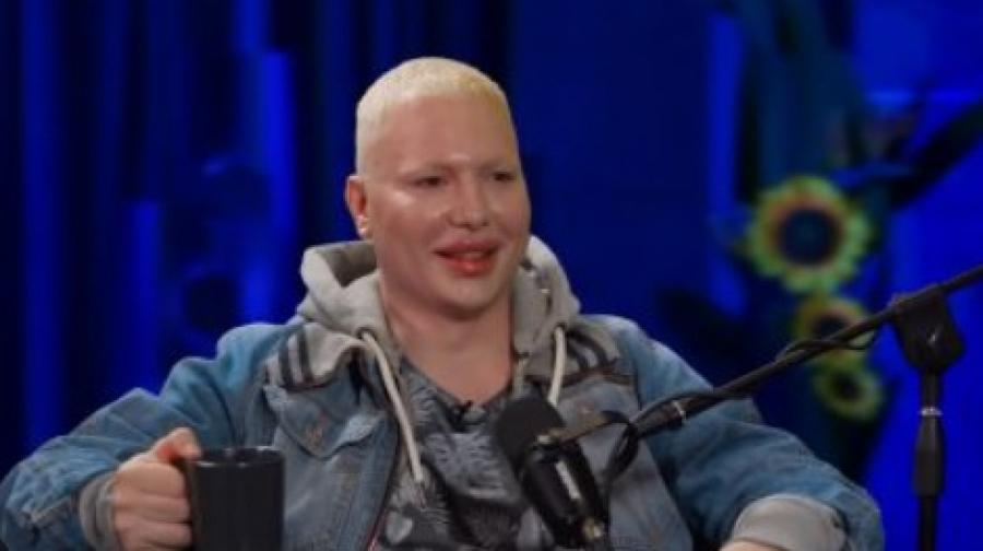 BIO JE OPASAN FRAJER, SAD SE IZDEFORMISAO OPERACIJAMA! Evo čime se sada bavi Brendon: "Živim u svom..." (FOTO)