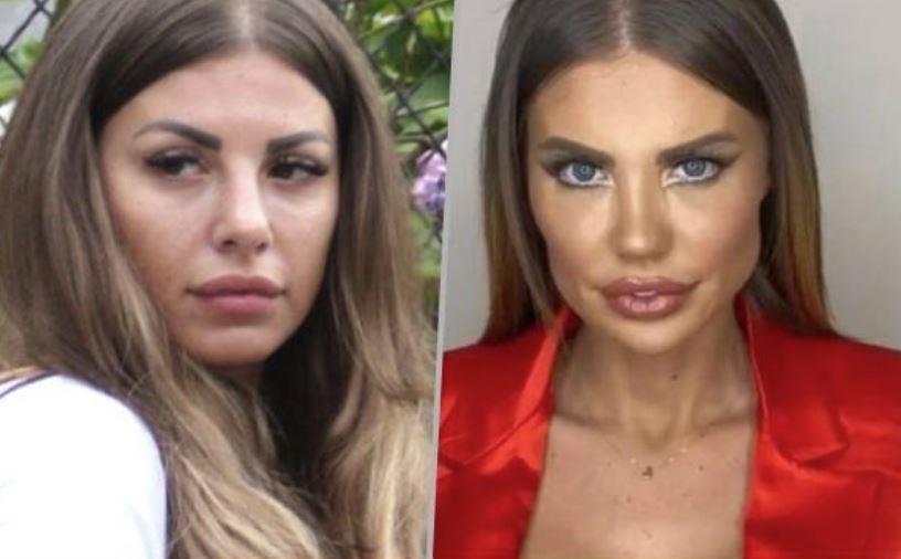DRAGANA MITAR VIŠE NE IZGLEDA OVAKO: Samo na licu imala više od 10 operacija, bivša modelsica otišla na korekciju brade, ne liči na sebe (FOTO)