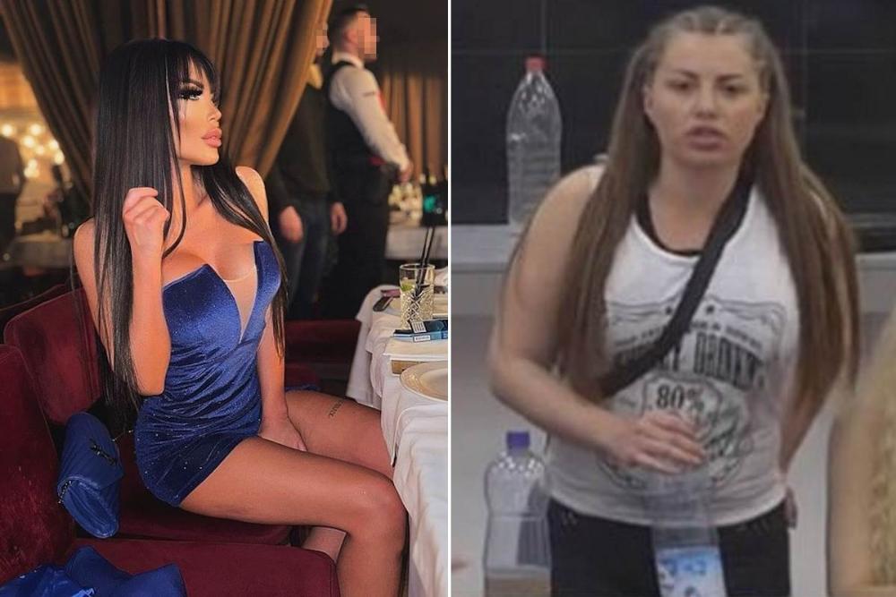 Operacije nosa, silikoni, fileri, sad je i ovo sredila: Dragana samo na licu imala 10 operacija, postala druga žena
