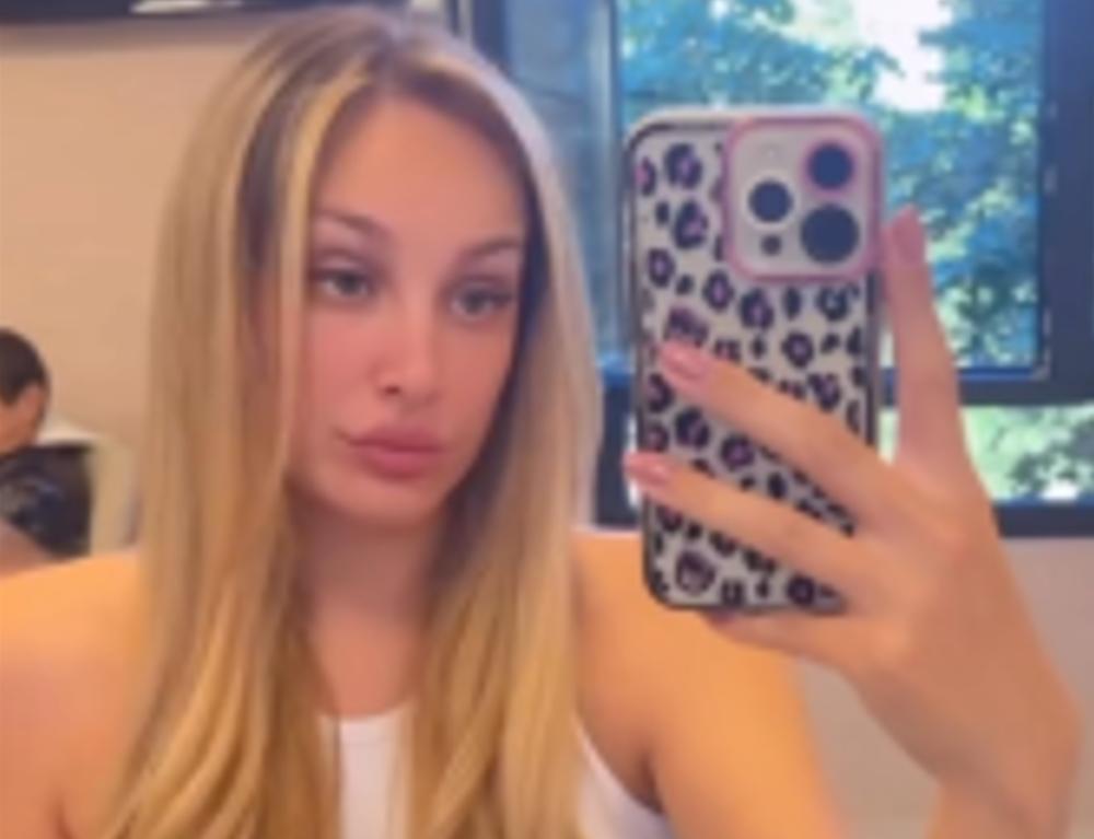 Luna Đogani se izbotoksirala posle operacije nosa, grudi i usana: Muž se nekada protivio prvoj operaciji!