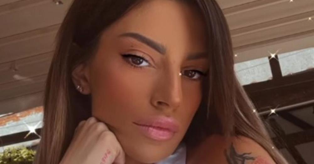 Tara Simov završila u bolnici! Pokazala ruku u zavoju posle povrede: Evo šta joj se desilo