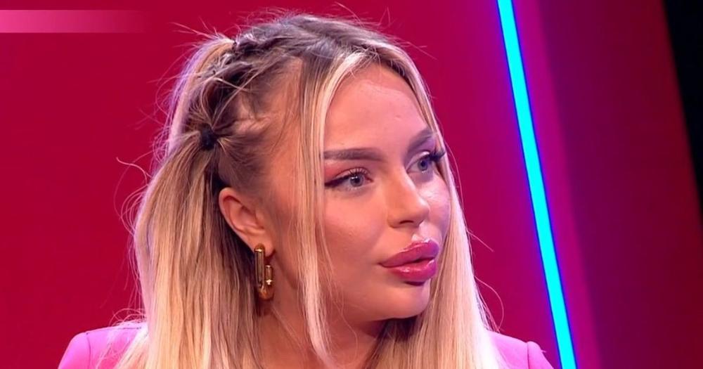 Preko 5.000€ dala za ulepšavanje: Bivša učesnica Elite potpuno promenila izgled, evo šta je sve radila na sebi