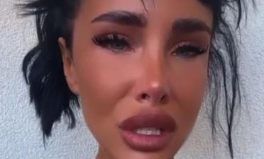 ALEKSANDRA SUBOTIĆ TVRDI DA JOJ JE ĆERKA PRETUČENA! Uznemirujuće fotografije: Ima ogrebotine po licu i vratu