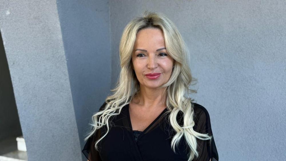 Sa pedeset sam prvi put stavljala botoks! Zuzija podelila sa cimerima šta je korigovala na licu, ovo bi svima preporučila (VIDEO)