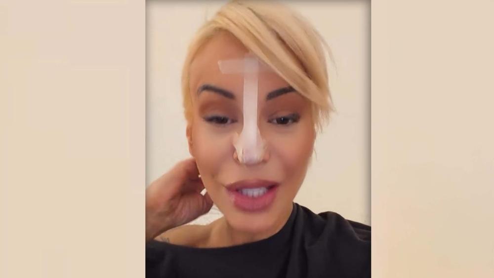 Dušica Jakovljević skroz oblepila nos flasterima, šokira: "Pao mi je vrh" nosa"
