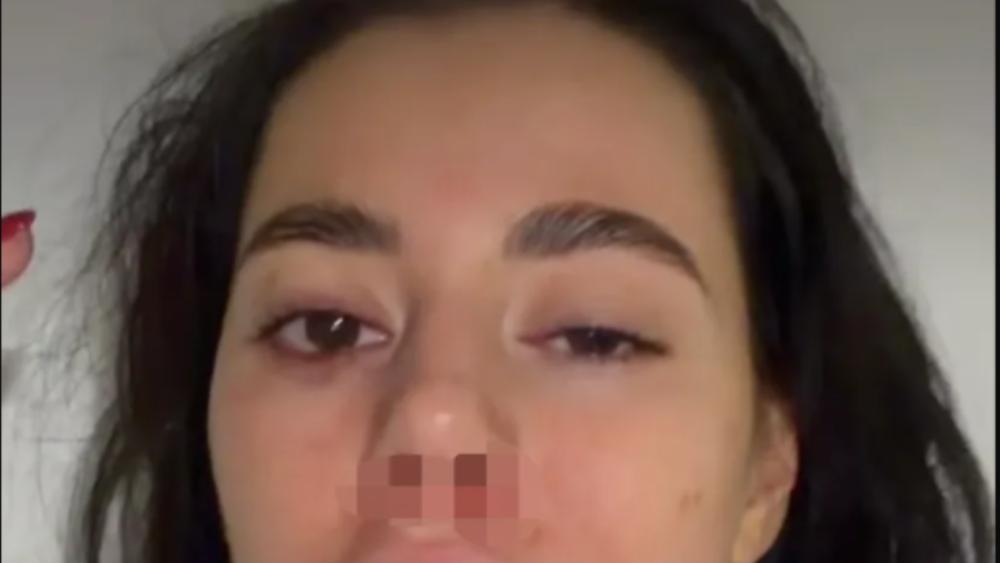 Jezive fotografije pretučene bivše rijaliti učesnice: "Devojke, pazite se"