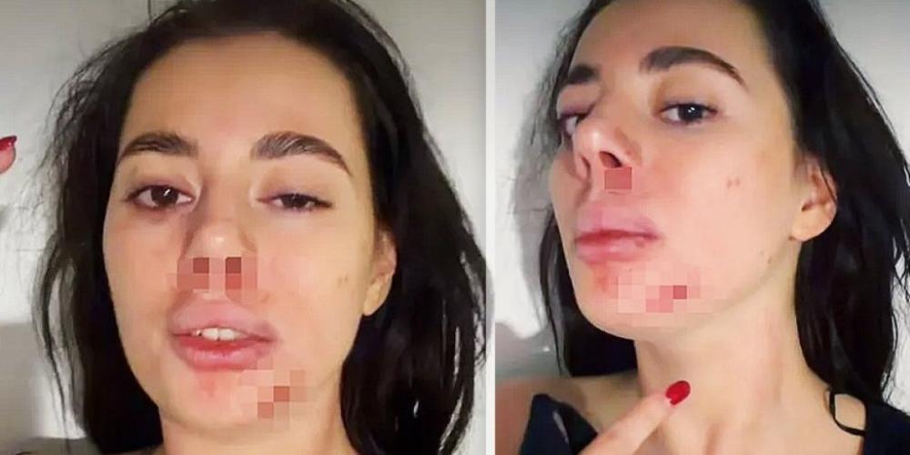 Uznemiravajuće fotografije! Ovako izgleda pretučena rijaliti učesnica - Cela u krvi i posekotinama