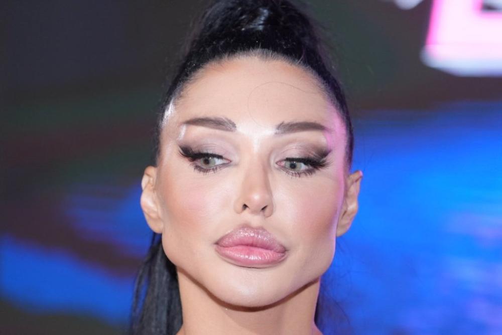 Maja Marinković izvadila silikon iz zadnjice!