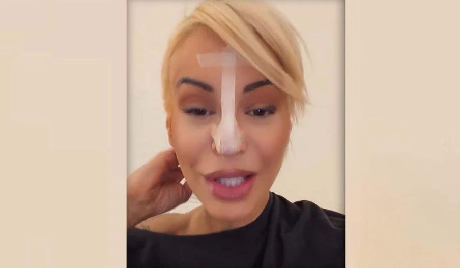 "ODLOŽILA SAM OPERACIJU, IMAM PREČA POSLA" Dušica Jakovljević objasnila zašto trakom lepi nos: Ne mora da mi bude prioritet