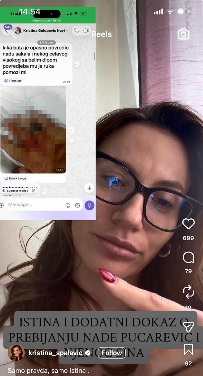 (FOTO) KRISTINA OBJAVILA DOKAZE DA JE KRISTIJAN PREBIO NADU PUCAREVIĆ: Ne sumnjajte u Nadu, evo vam slika Kristijanove krvave ruke