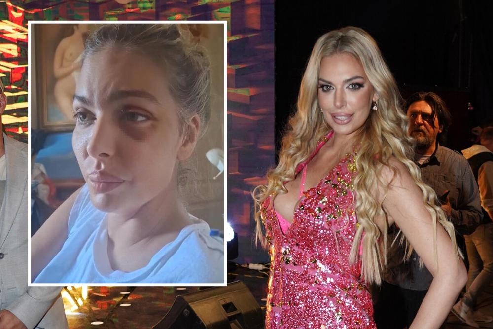 "DOBILA SAM POZIV, ALI IMAM SVOJU CENU" Ava Karabatić nakon jezivog nasilja otkrila detalje pregovora za Elitu