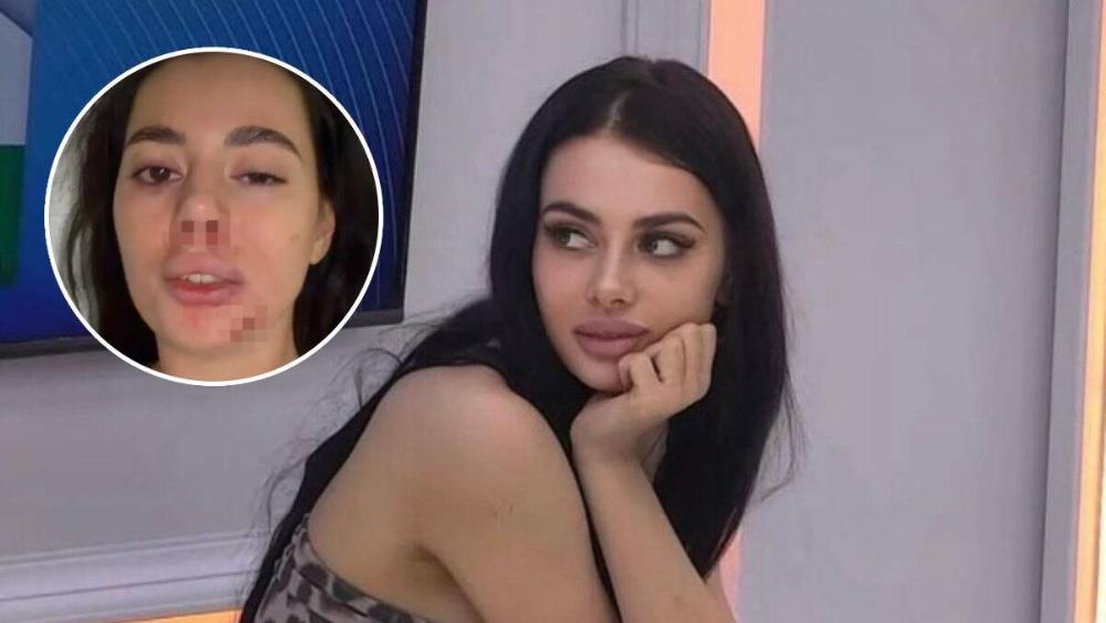 Prvo oglašavanje teško pretučene rijaliti učesnice: Ivana sva u modricama, javno upozorila devojke