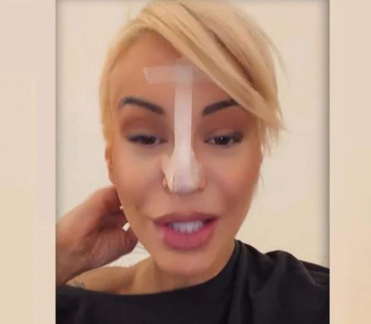 Dušici Jakovljević pao vrh nosa (foto)