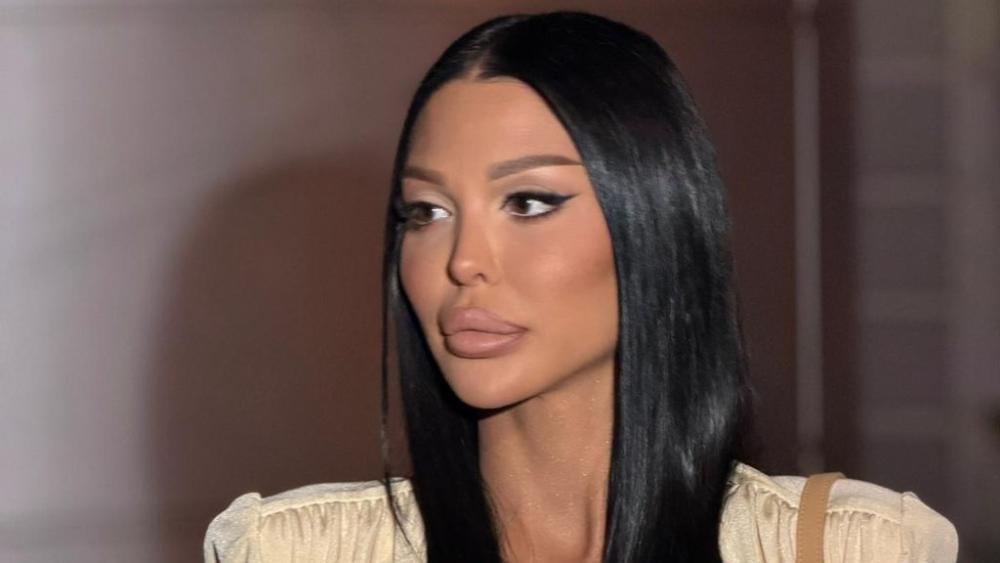 Operisana Maja Marinković! Ovako izgleda nakon vađenja silikona iz zadnjice (VIDEO)