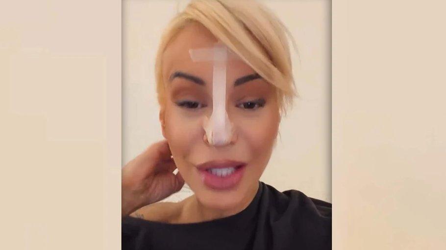 PAO MI JE VRH NOSA! Dušica Jakovljević SKROZ OBLEPILA NOS FLASTERIMA: Javno se oglasila i otkrila metodu kojom rešava problem (FOTO)