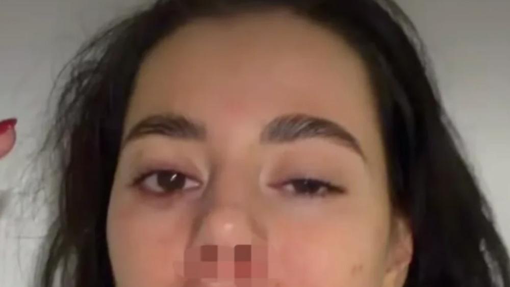 Bivša zadrugarka podelila jezive fotografije nakon što je pretučena