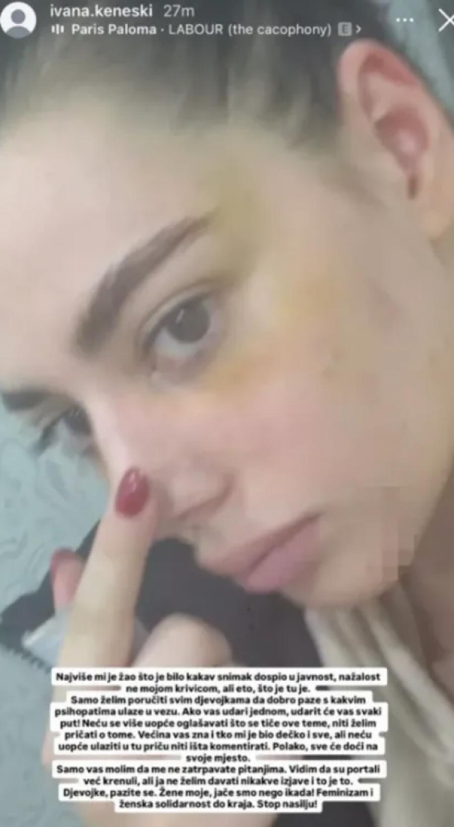 PRVE SLIKE PRETUČENE BIVŠE ZADRUGARKE: Lice joj je UNAKAŽENO od batina, KRV joj ŠIKLJA, hitno se oglasila i otkrila sve!