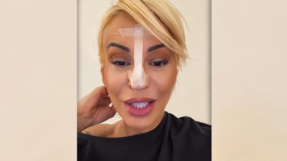 Dušica Jakovljević sa zavojima na licu! Voditeljka zabrinula javnost, otkriveno šta joj se dogodilo (FOTO)