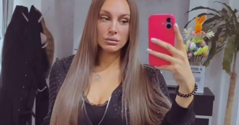 "Bockam se..." Luna Đogani posetila doktora pa pokazala kako se neguje: "Važna je mera i prirodnost"