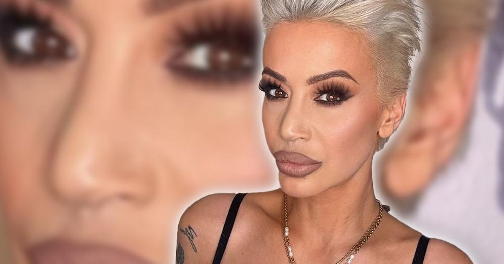 "Zalepim vrh nosa koji je pao i podignem ga flasterom": Dušica o zdravstvenom problemu: "Nema plakanja"